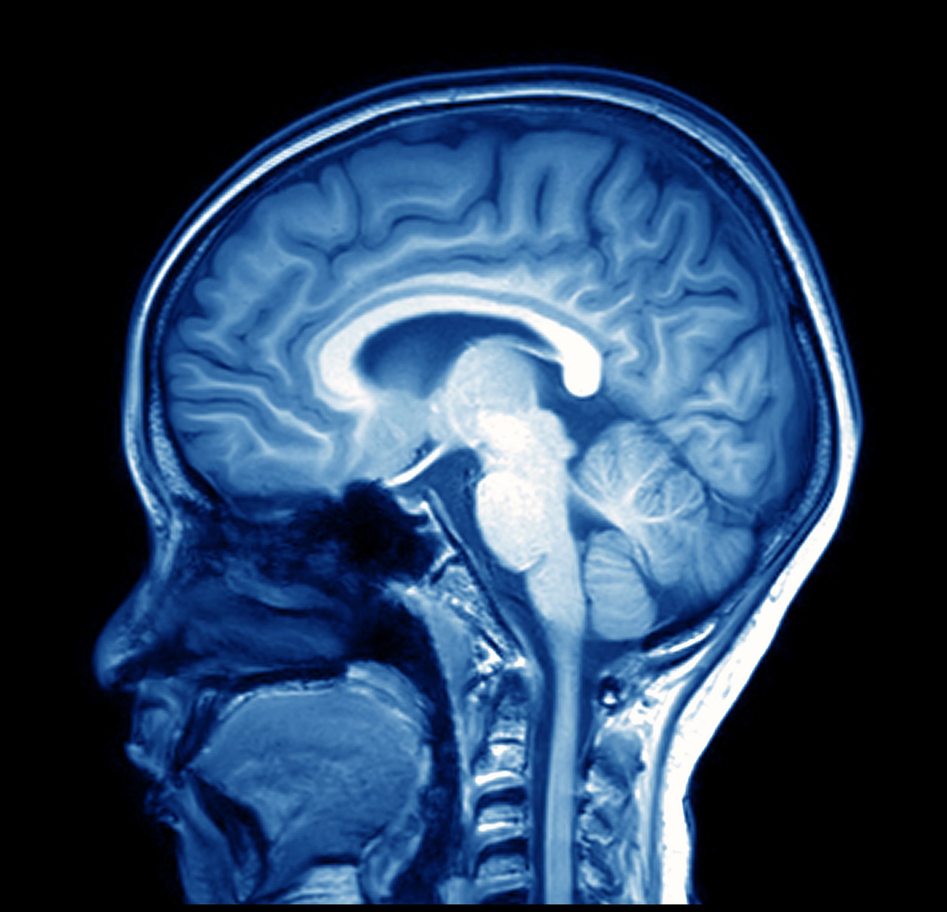MRI vs MRA - When is an Arthrogram needed?
