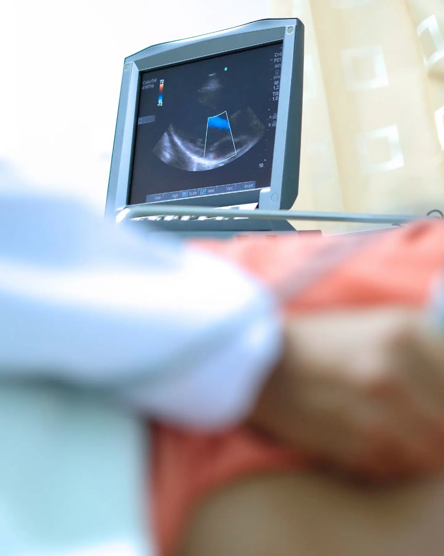 Echocardiography (1)