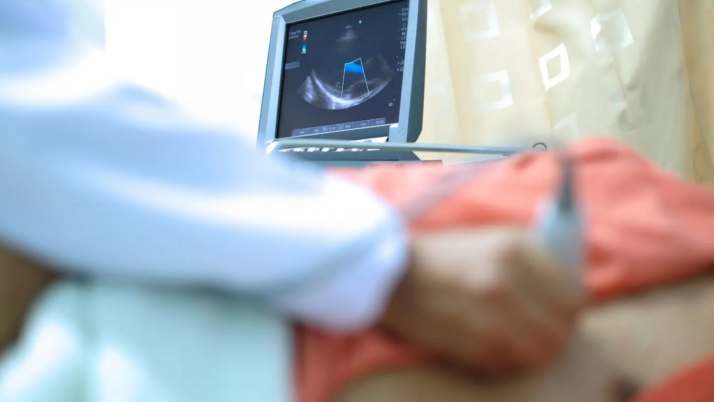 Echocardiography (1)